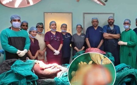 Jabalpur News: 22 वर्षीय महिला के पेट से निकाला 22 किलो का दुर्लभ ट्यूमर