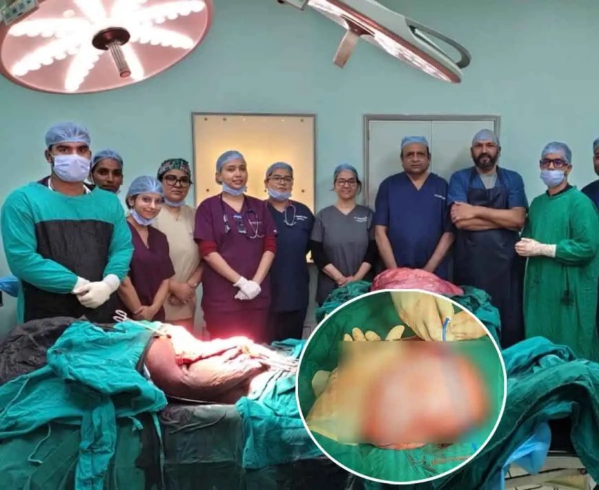 Jabalpur News: 22 वर्षीय महिला के पेट से निकाला 22 किलो का दुर्लभ ट्यूमर